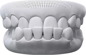 invisalign Teeth